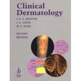 Clinical Dermatology by Savin, John Paperback Book