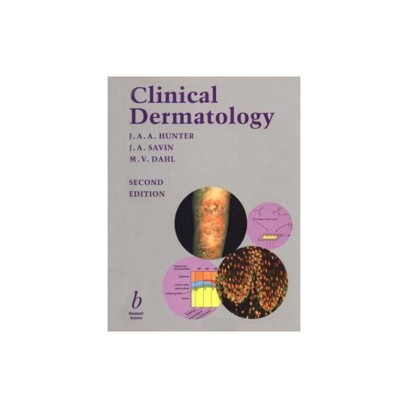 Clinical Dermatology by Savin, John Paperback Book