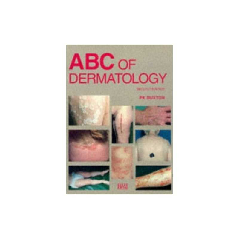ABC of Dermatology (ABC Series) by Buxton, Paul K. Paperback Book  Fast