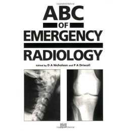 ABC of Emergency Radiology (ABC Series) Paperback Book