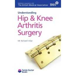 Hip and Knee Arthritis Surgery (Understanding)... by Richard N. Villar Paperback