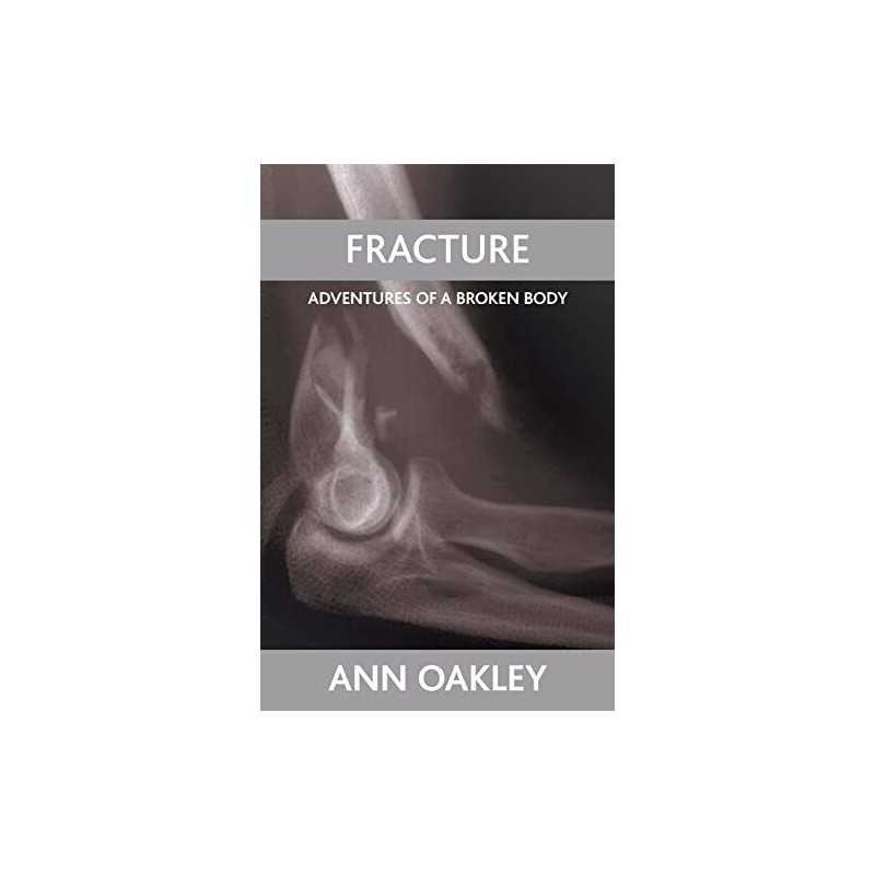 Fracture: Adventures of a broken body by Oakley, Ann Paperback Book