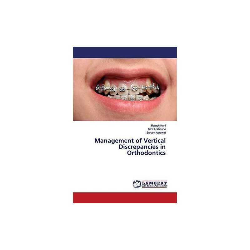 Management of Vertical Discrepancies..., Agrawat, Soham