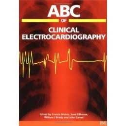 ABC of Clinical Electrocardiography (ABC Series) Paperback Book  Fast