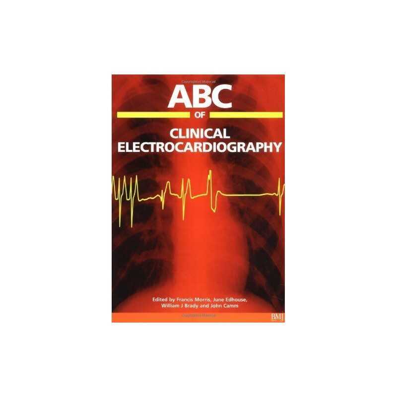 ABC of Clinical Electrocardiography (ABC Series) Paperback Book  Fast