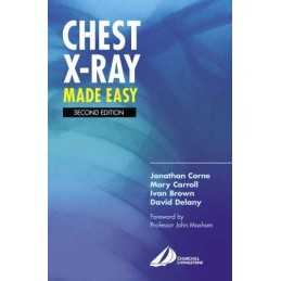Chest X-Ray Made Easy by Brown Dr., Ivan Paperback Book