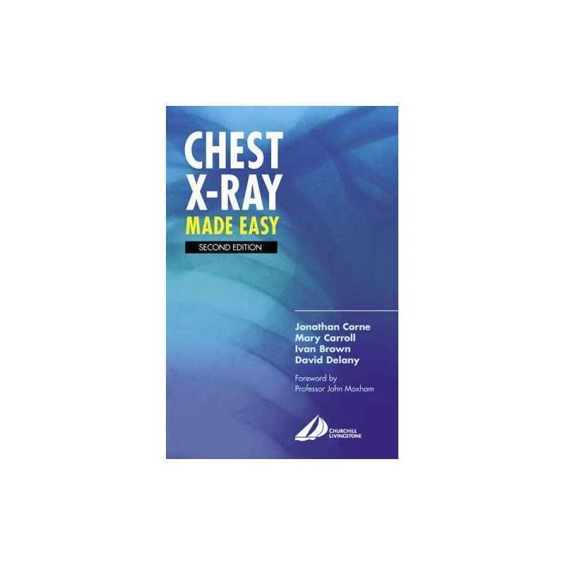 Chest X-Ray Made Easy by Brown Dr., Ivan Paperback Book