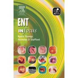 ENT In Focus by Stafford, Nicholas D. Paperback Book