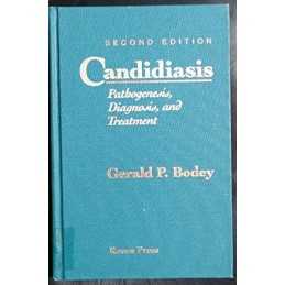 Candidiasis: Pathogenesis, Diagnosi..., Bodey, Gerald P