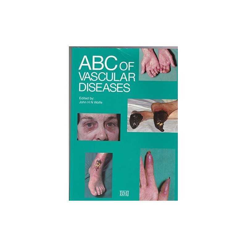 ABC of Vascular Diseases (ABC Series) Paperback Book