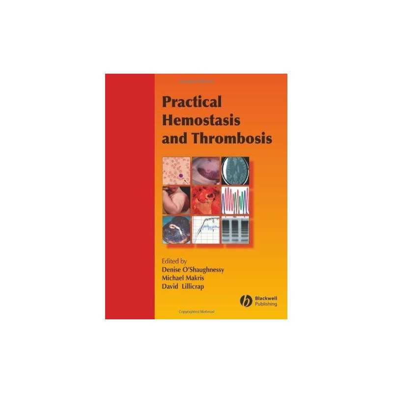 Practical Hemostasis and Thrombosis
