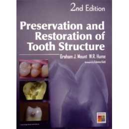 Preservation and Restoration of Tooth Structure by Hume, W.R. Hardback Book The