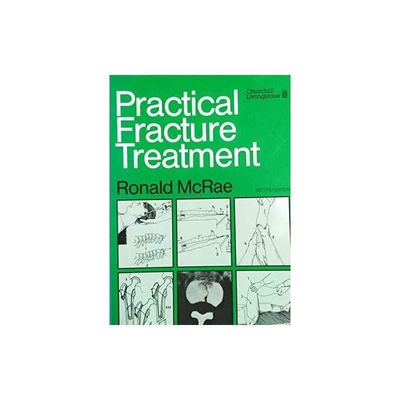 Practical Fracture Treatment, McRae, Ronald