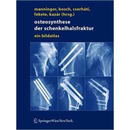 Osteosynthese der Schenkelhalsfraktur - 9783211201527