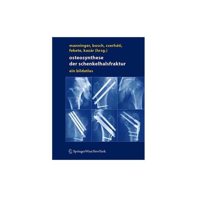 Osteosynthese der Schenkelhalsfraktur - 9783211201527