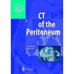 CT of the Peritoneum - 9783642625497