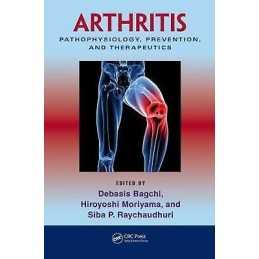 Arthritis - 9781439816868