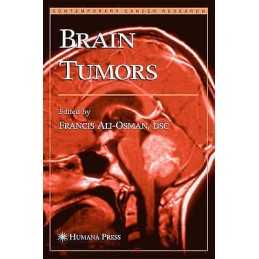 Brain Tumors - 9781588290427