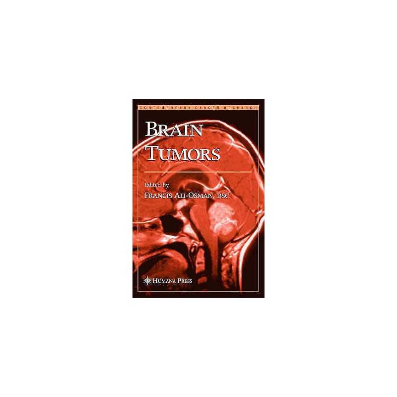 Brain Tumors - 9781588290427
