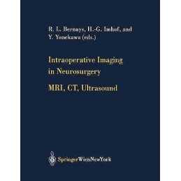 Intraoperative Imaging in Neurosurgery - 9783211838358