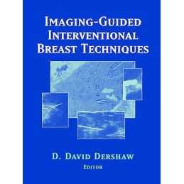 Imaging-Guided Interventional Breast Techniques - 9780387954547