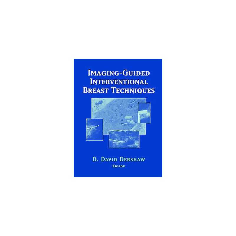 Imaging-Guided Interventional Breast Techniques - 9780387954547