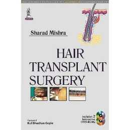 Hair Transplant Surgery - 9789351520795