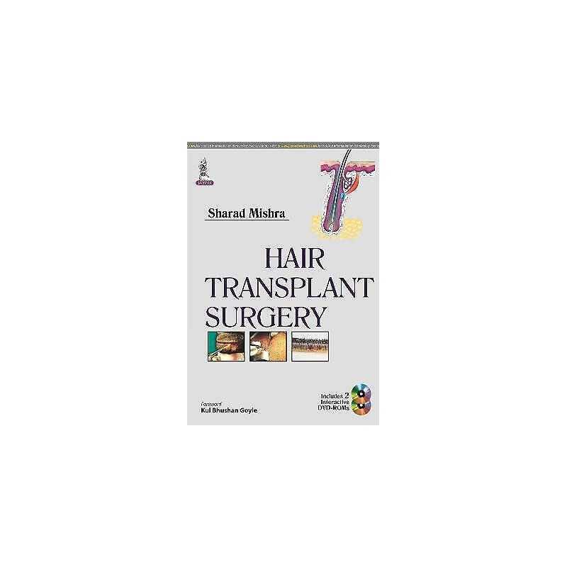 Hair Transplant Surgery - 9789351520795