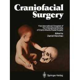 Craniofacial Surgery - 9783642828775