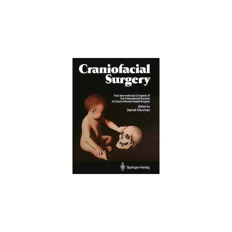 Craniofacial Surgery - 9783642828775