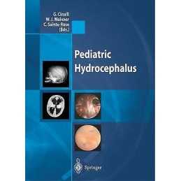 Pediatric Hydrocephalus - 9788847021730