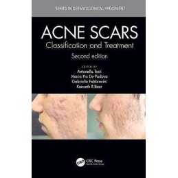 Acne Scars - 9781138894228