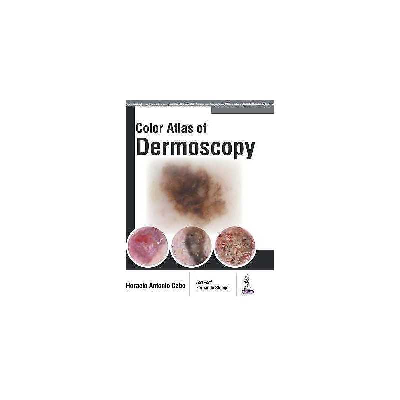Color Atlas of Dermoscopy - 9789386056306