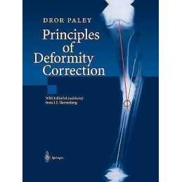 Principles of Deformity Correction - 9783642639531