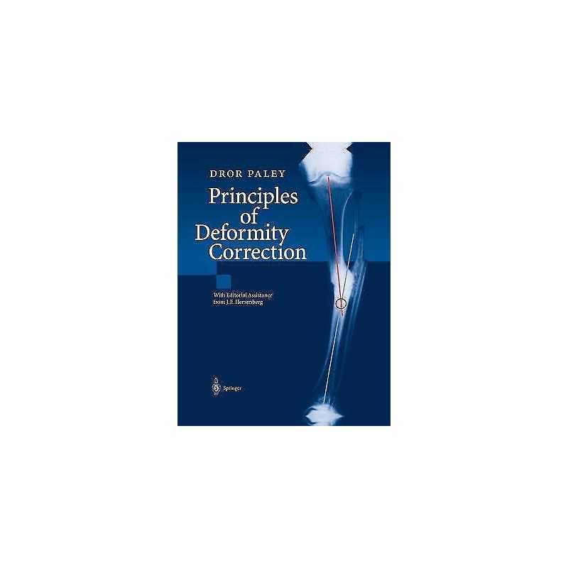Principles of Deformity Correction - 9783642639531