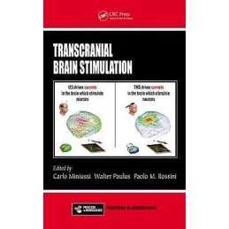 Transcranial Brain Stimulation - 9781439875704