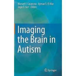 Imaging the Brain in Autism - 9781461468424