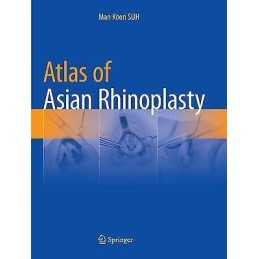 Atlas of Asian Rhinoplasty - 9789811342042