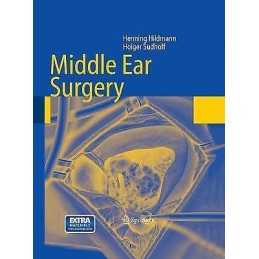 Middle Ear Surgery - 9783662499894