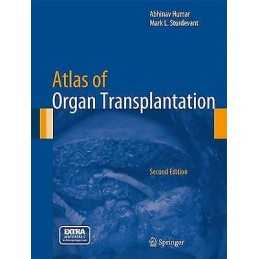 Atlas of Organ Transplantation - 9781447147749