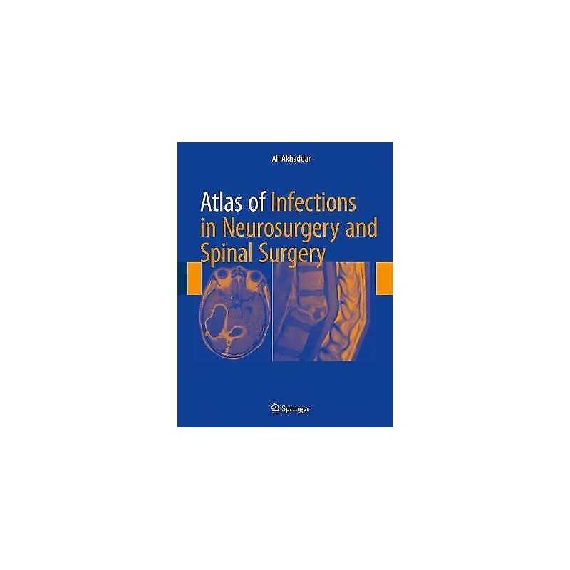 Atlas of Infections in Neurosurgery and Spinal Surgery - 9783319600857