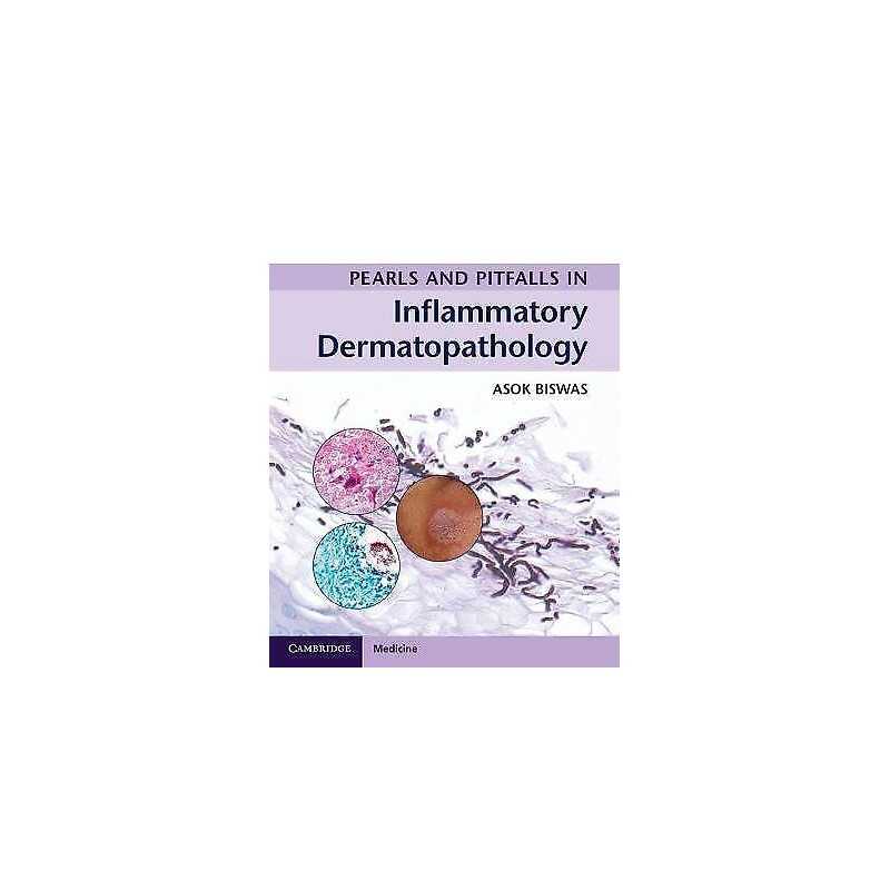 Pearls and Pitfalls in Inflammatory Dermatopathology - 9781316605998