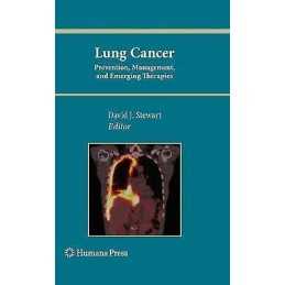 Lung Cancer: - 9781617796845