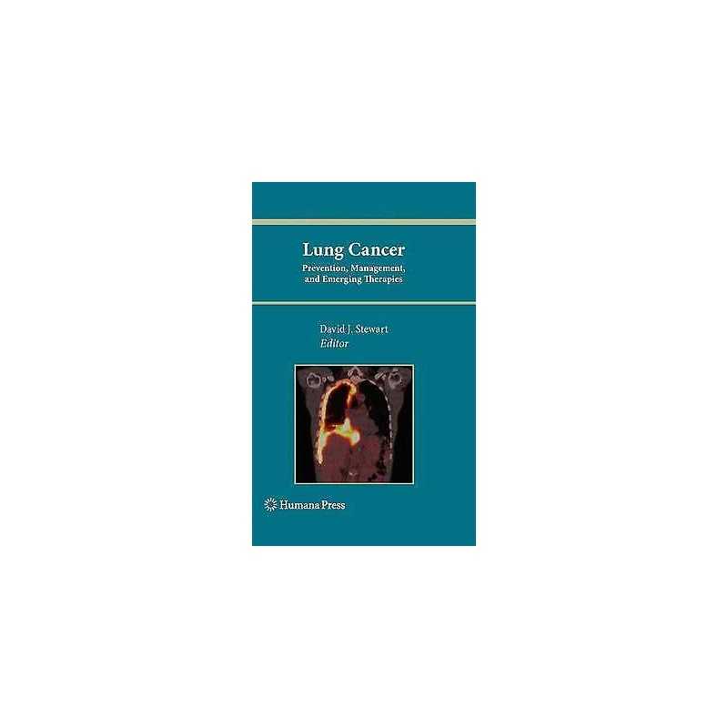 Lung Cancer: - 9781617796845