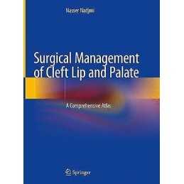 Surgical Management of Cleft Lip and Palate - 9783319916859