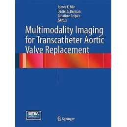 Multimodality Imaging for Transcatheter Aortic Valve Replacement - 9781447127970