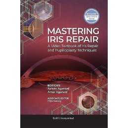 Mastering Iris Repair - 9781630917265
