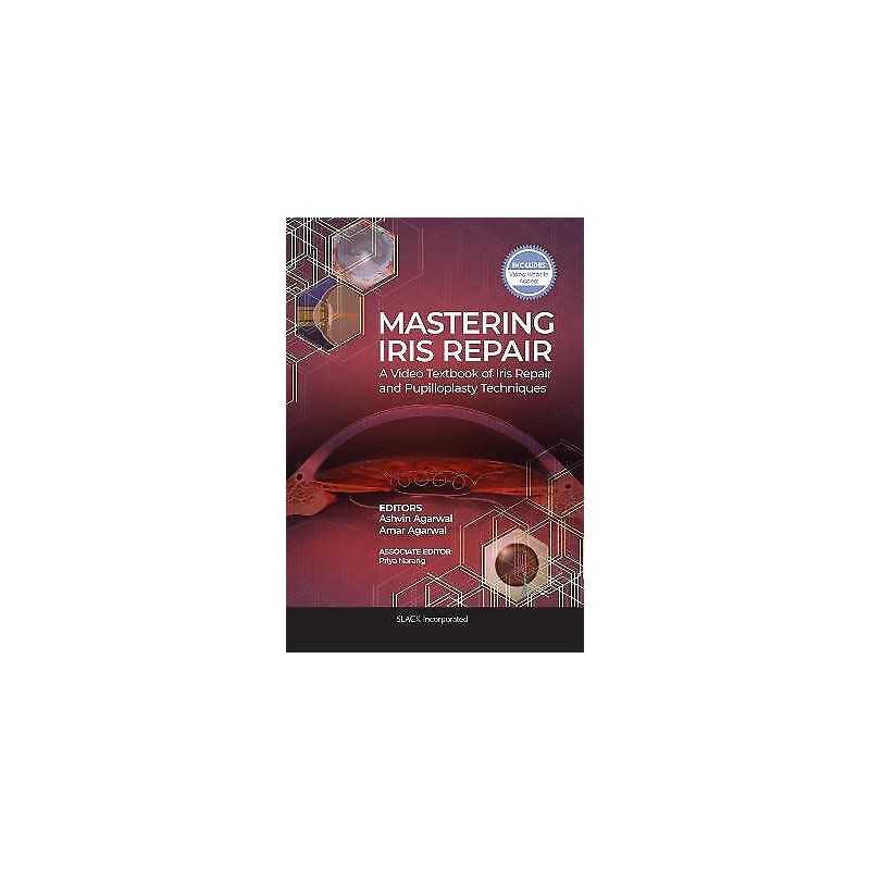 Mastering Iris Repair - 9781630917265