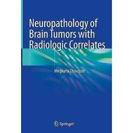 Neuropathology of Brain Tumors with Radiologic Correlates - 9789811571251