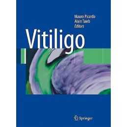 Vitiligo - 9783642422744
